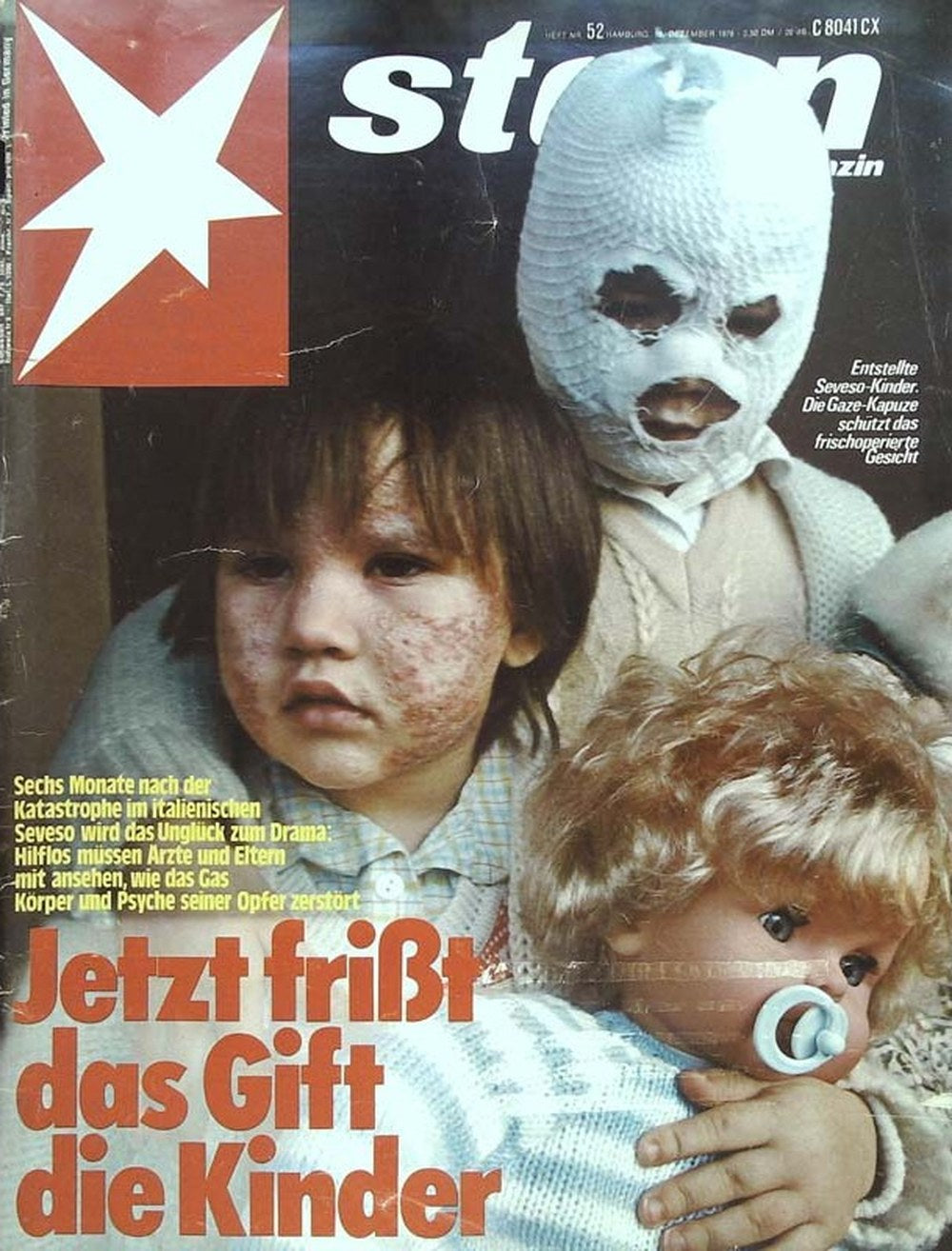 Stern Magazin Deutschland 1976-52 Seveso-Katastrophe Giftgasunfall Chlorakne